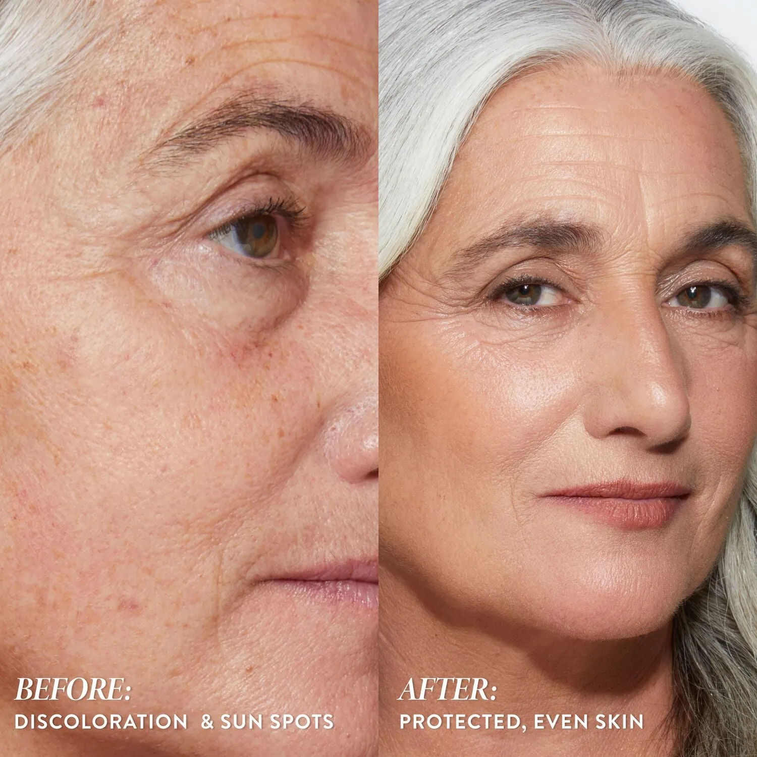 LG_BetterThanBlock_Before_After_SkinBenefits_Shona-ECommerce_JPG.webp