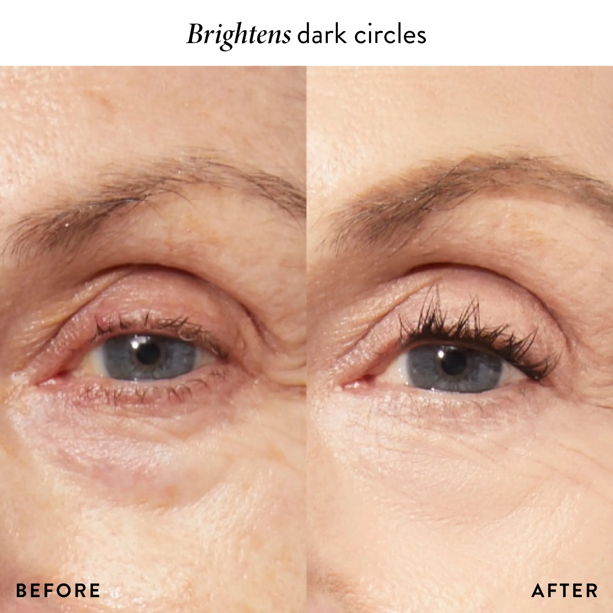 LG_Cancel-n-ConcealSkinPerfector_PDP_Model_BeforeandAfter_Macro_WithBenefit.webp