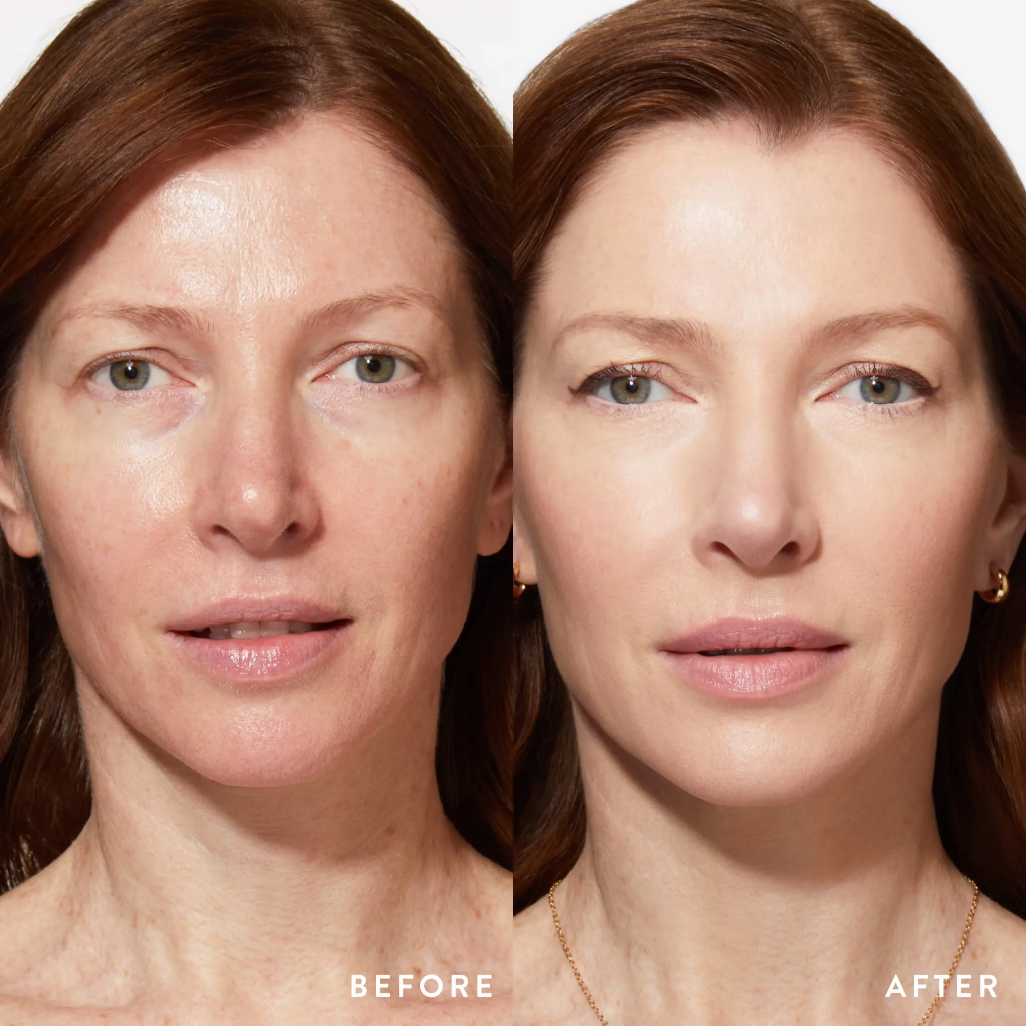 LGxBliss_Better_BrighterSkinKit_Before-After.webp