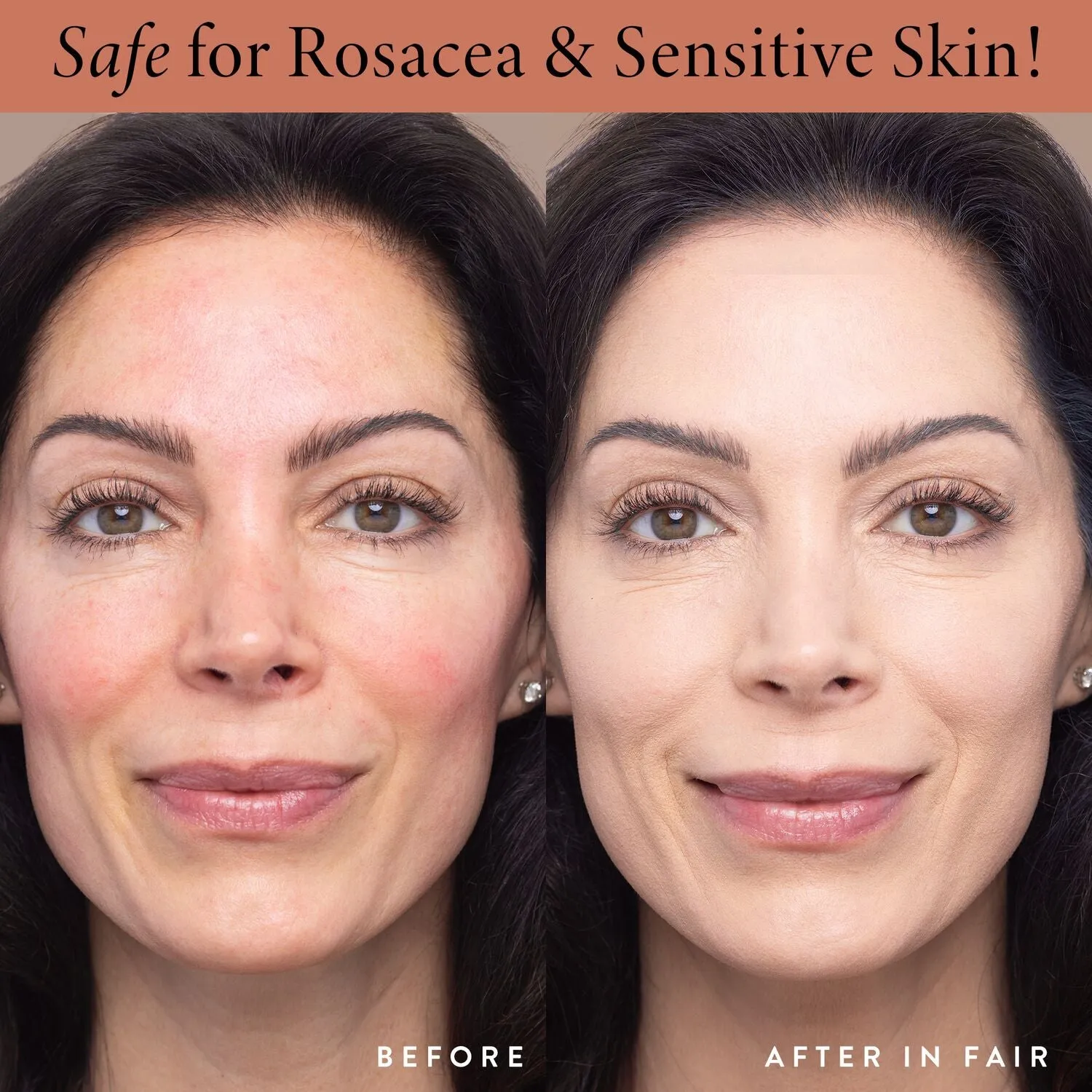 LauraGeller_DoubleTakeLiquidFoundation_BEforeandAfter_rosacea-ECommerce_JPG.webp